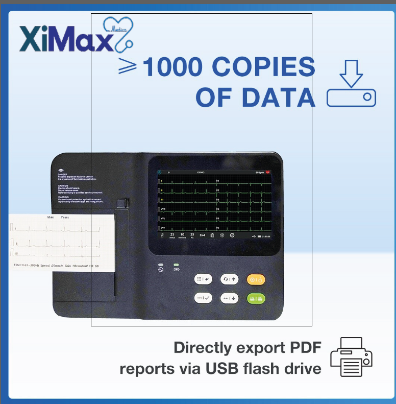 3 Channel ECG Machine - Image 2