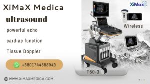 Trolley Color Doppler Ultrasound