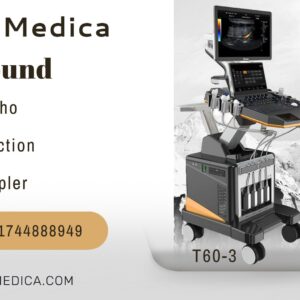 Trolley Color Doppler Ultrasound
